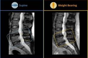 csm_gScanBrio_DiscModification_505c786497-379x283